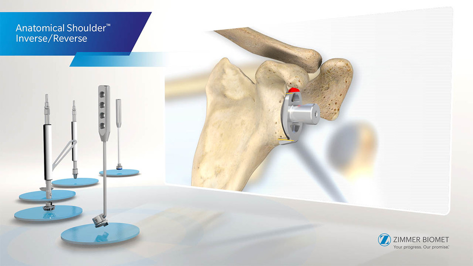 Anatomical Shoulder™ Inverse/Reverse