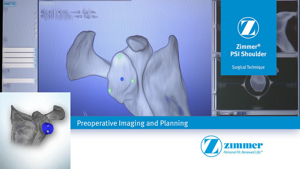 Zimmer® PSI Shoulder Preoperative Imaging