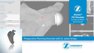 Zimmer® PSI Shoulder Trabecular Metal™ Reverse Glenoid Base Plate ...
