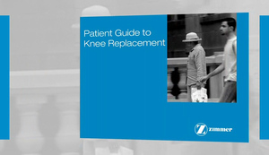 Patient Guide to Knee Replacement